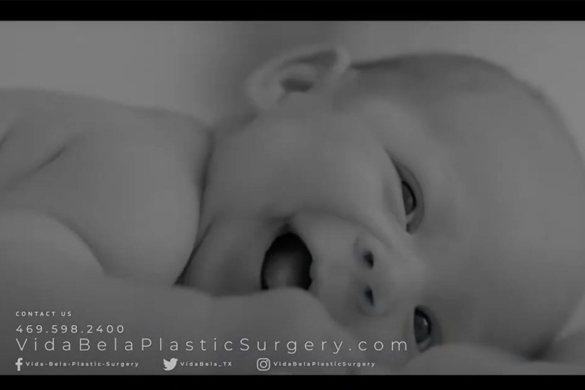 Craniosynostosis and craniofacial procedures at Vida Bela Plastic Surgery